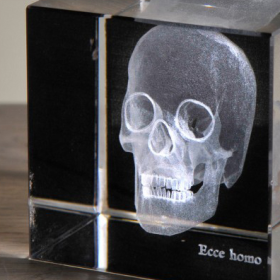 Radiographie 3D Crâne petit