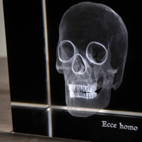 Radiographie 3D Crâne grand
