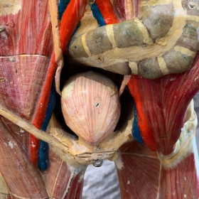 Anatomical wax of human skull