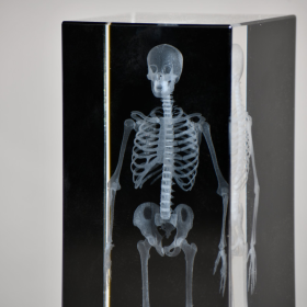 Radiographie 3D de squelette
