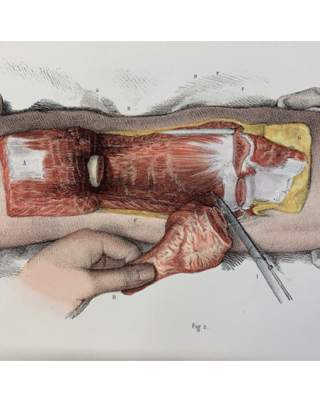 Anatomy: "L'Anatomie de L'Homme" by Bourgery and Jacob -1837/1843