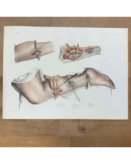 Anatomy: "L'Anatomie de L'Homme" by Bourgery and Jacob -1837/1843
