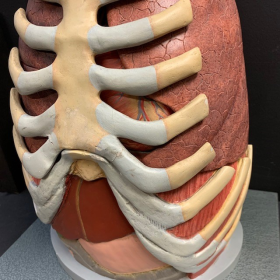 Anatomical torso in removable plaster - Anatomical skinning - SOMSO