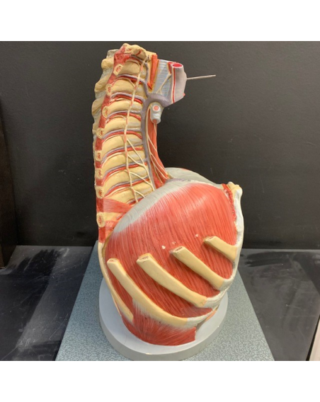Anatomical torso in removable plaster - Anatomical skinning - SOMSO