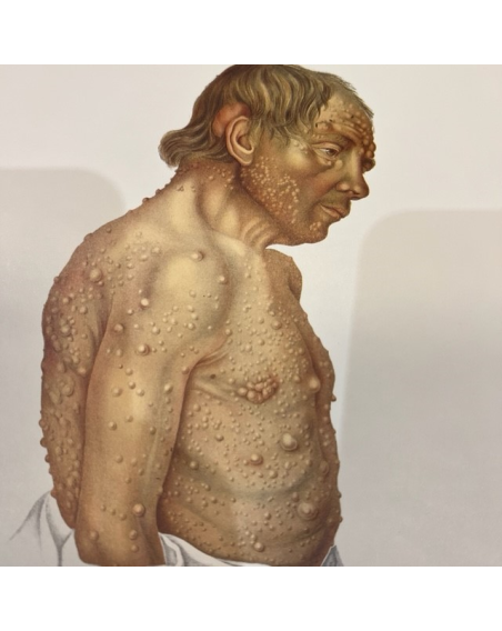 Sickness and deformity plate - Reprint (skin disease)