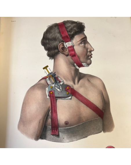 L'Anatomie de L'Homme - by Bourgery and Jacob - 1839 - Volume 7: Atlas of Operative Medicine