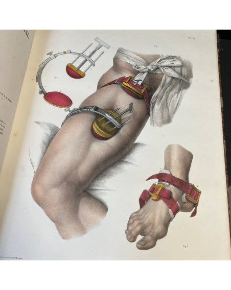 L'Anatomie de L'Homme - by Bourgery and Jacob - 1839 - Volume 7: Atlas of Operative Medicine