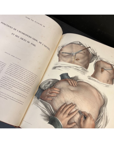 L'Anatomie de L'Homme - by Bourgery and Jacob - 1840 - Volume 7: Atlas of Operative Medicine