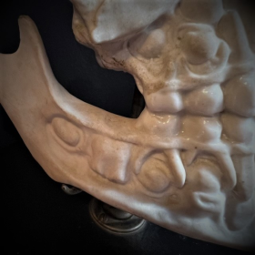Human jaws in porcelain mounted on a Napoleon III base - Anatomical model - XIXth century
