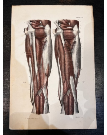Anatomic lithography: "L'Anatomie de L'Homme" by Bourgery and Jacob -1844
