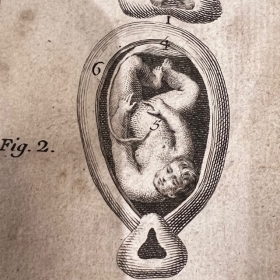 De l'Homme et de la Femme - Par M. de Lignac - Tome 3 - Anatomie de la procréation - 1774