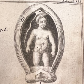 De l'Homme et de la Femme - Par M. de Lignac - Tome 3 - Anatomie de la procréation - 1774