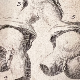 De l'Homme et de la Femme - By M. de Lignac - Volume 3 - Procreation Anatomy - 1774