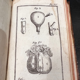 De l'Homme et de la Femme - Par M. de Lignac - Tome 3 - Anatomie de la procréation - 1779