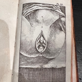 De l'Homme et de la Femme - Par M. de Lignac - Tome 3 - Anatomie de la procréation - 1779