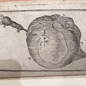 De l'Homme et de la Femme - Par M. de Lignac - Tome 3 - Anatomie de la procréation - 1779