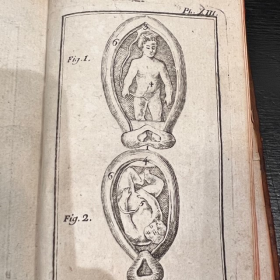 De l'Homme et de la Femme - Par M. de Lignac - Tome 3 - Anatomie de la procréation - 1779