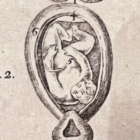 De l'Homme et de la Femme - Par M. de Lignac - Tome 3 - Anatomie de la procréation - 1779