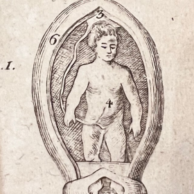 De l'Homme et de la Femme - By M. de Lignac - Volume 3 - Procreation Anatomy - 1779