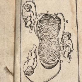 De l'Homme et de la Femme - Par M. de Lignac - Tome 3 - Anatomie de la procréation - 1779