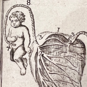 De l'Homme et de la Femme - Par M. de Lignac - Tome 3 - Anatomie de la procréation - 1779