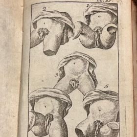 De l'Homme et de la Femme - Par M. de Lignac - Tome 3 - Anatomie de la procréation - 1779