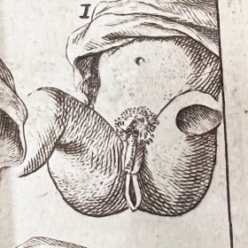 De l'Homme et de la Femme - Par M. de Lignac - Tome 3 - Anatomie de la procréation - 1779