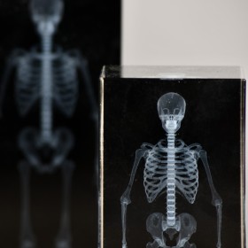 Radiographie 3D de squelette