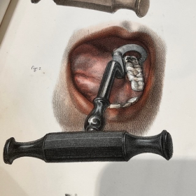 Dental key - Garengeot key - ROISSARD - 19th century