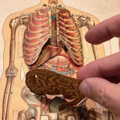 Planche démontable - Anatomie de l'Homme par VIGOT Frères - 1900