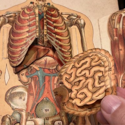 Planche démontable - Anatomie de l'Homme par VIGOT Frères - 1900