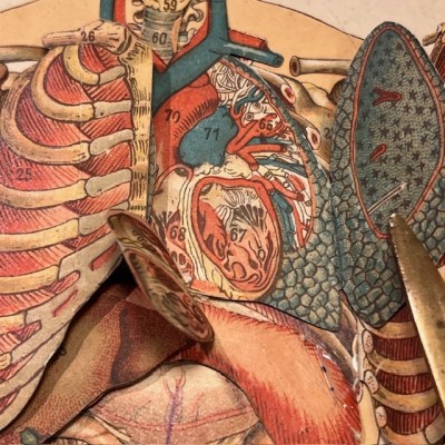 Planche démontable - Anatomie de l'Homme par VIGOT Frères - 1900