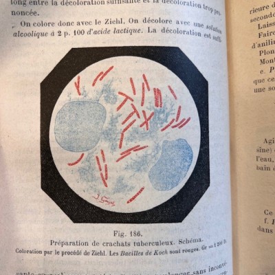 Précis de Bactériologie - Bacteriology - By Courmont - 1911