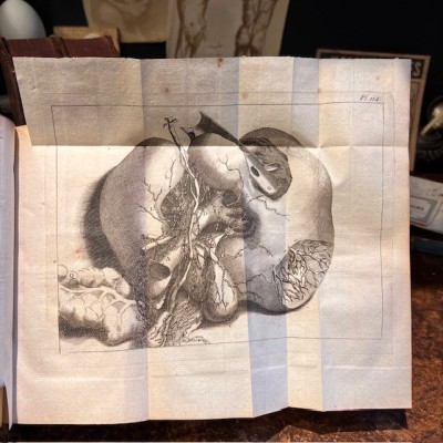 Bibliothèque Choisie de Médecine - Volume 16 - F.PLANQUE - 1761