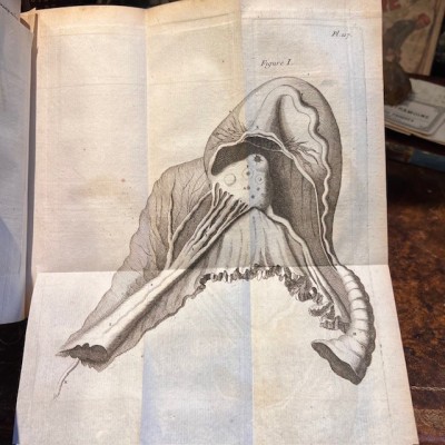 Bibliothèque Choisie de Médecine - Volume 16 - F.PLANQUE - 1761