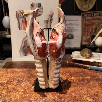 Dr Auzoux - Modèle anatomique de larynx - Papier-mâché