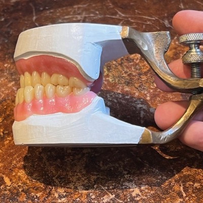 Articulateur Dentaire en bronze - 1920 - Instrument de Dentisterie