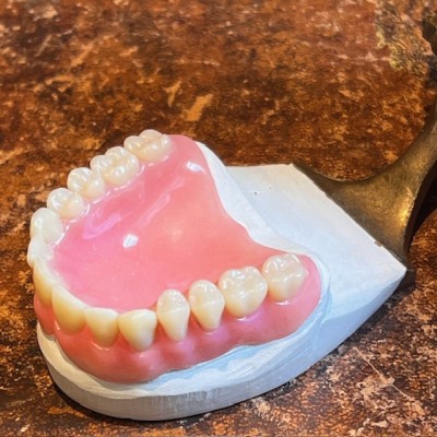 Articulateur Dentaire en bronze - 1920 - Instrument de Dentisterie