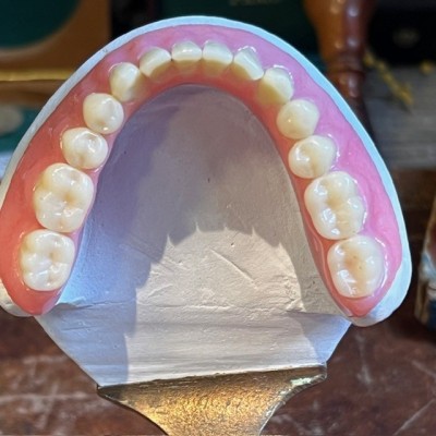 Bronze dental articulator (circa 1920) - Dental instrument - Dentistry