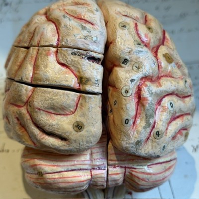 Dr Auzoux - Modèle anatomique du cerveau - Papier-mâché - 1874