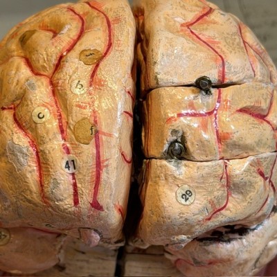 Dr Auzoux - Modèle anatomique du cerveau - Papier-mâché - 1874