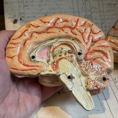 Dr Auzoux - Modèle anatomique du cerveau - Papier-mâché - 1874